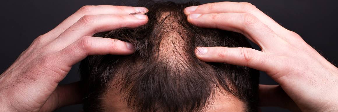 Beschadigde haarzakjes herstellen voor een gezonde haargroei